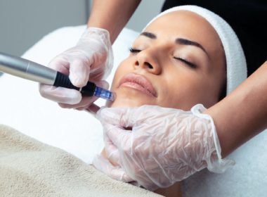 Microneedling At Home: What Does It Do? Best Serums For Microneedling