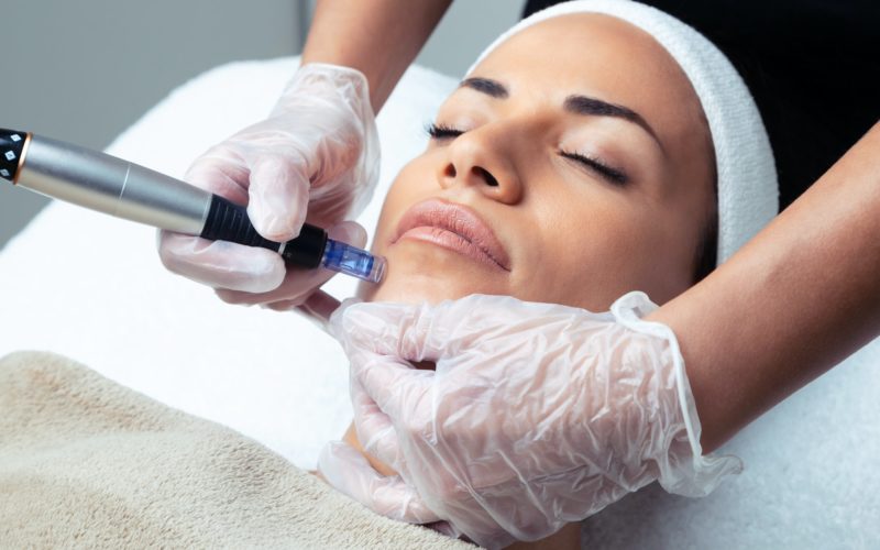 Microneedling At Home: What Does It Do? Best Serums For Microneedling