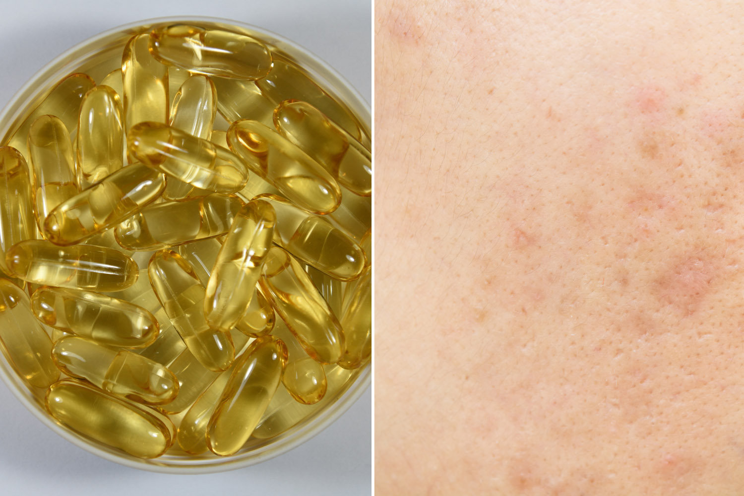 Does Squalane Clog Pores? (Based On Research) BeautyWayMag