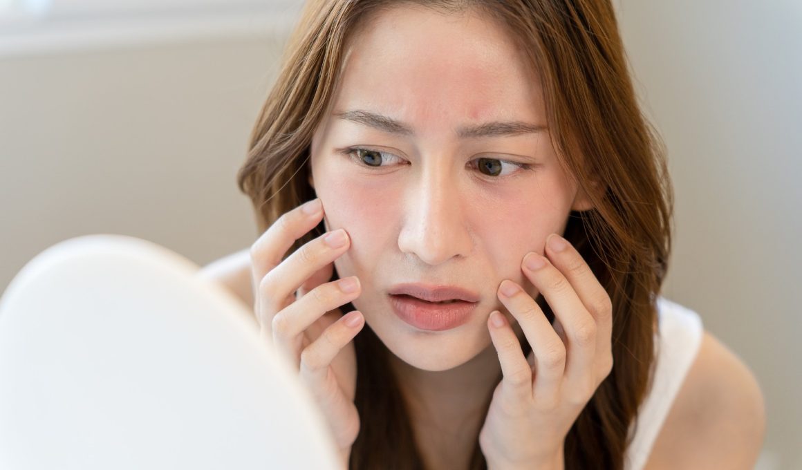 How to Get Rid of Redness on Face