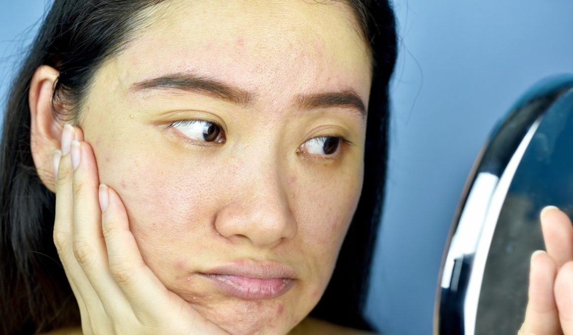How to Get Rid of Clogged Pores By Yourself